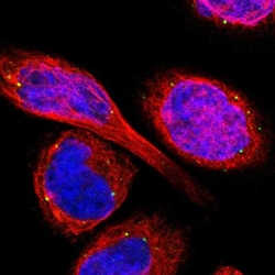 TMEM25 Antibody, Novus Biologicals:Antibodies:Primary Antibodies